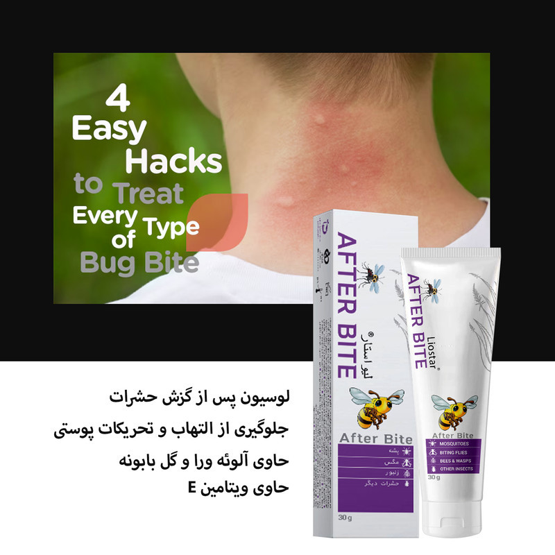 لوسیون پس از گزش حشرات لیو استار مدل After bite2 حجم 30 گرم بسته دو عددی