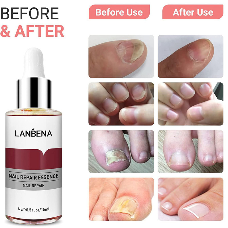 سرم ترمیم کننده ناخن لنبنا مدل REPAIR ESSENCE حجم 15 میلی لیتر