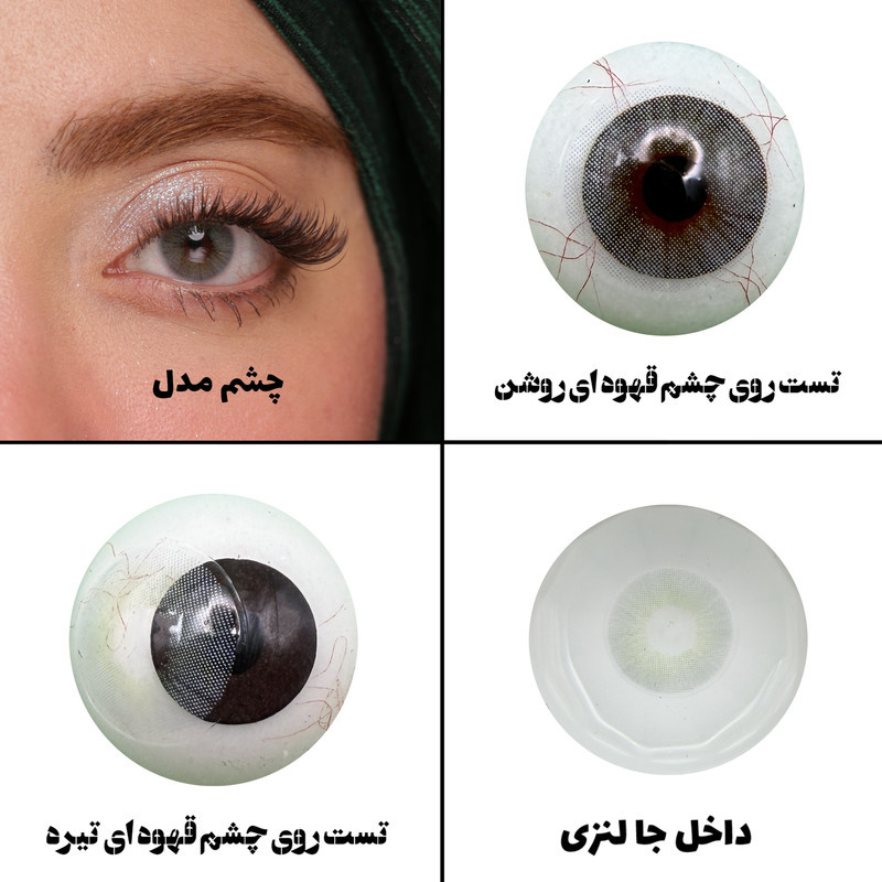 لنز چشم رویال ویژن مدل ADDICT GR کد 4 رنگ طوسی روشن