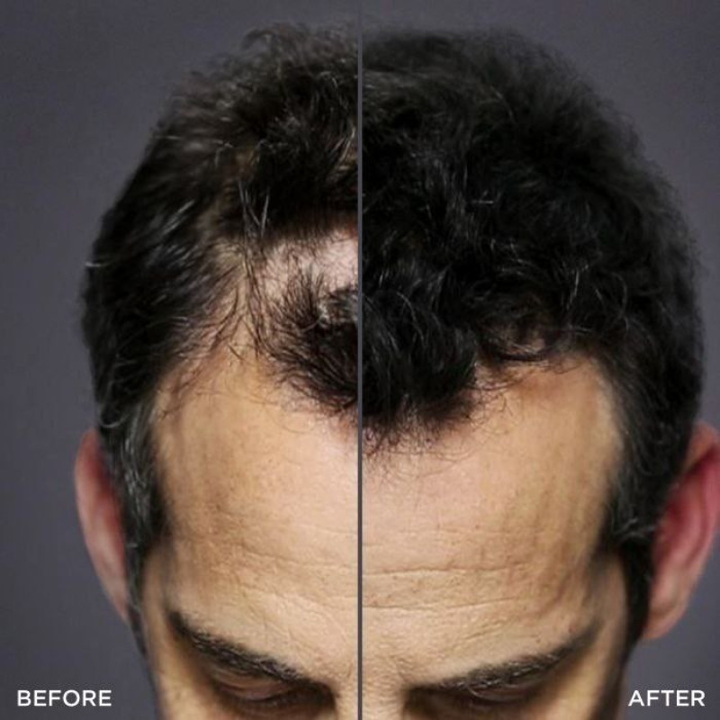 پودر پرپشت کننده مو تاپیک مدل FIBER وزن 10.3 گرم رنگ سفید