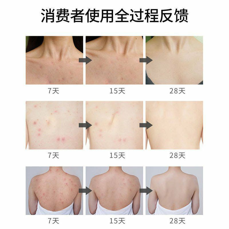 اسپری ضد جوش بدن سیازو رایکو مدل سنتلا آسیتکا حجم 150 میلی لیتر