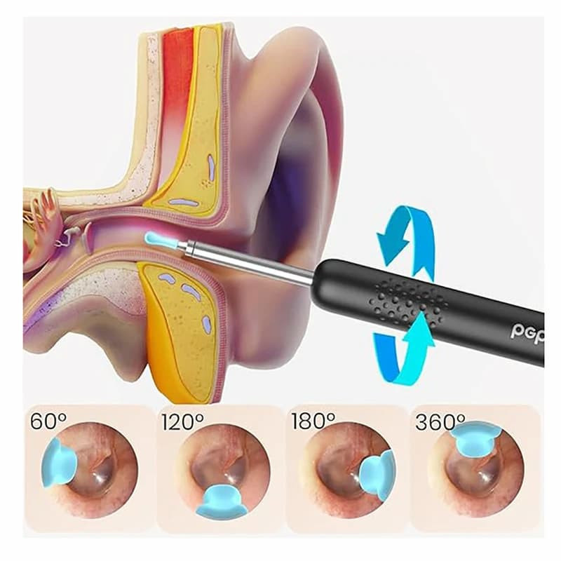 گوش پاک‌کن برقی ببیرد مدل R1 2025