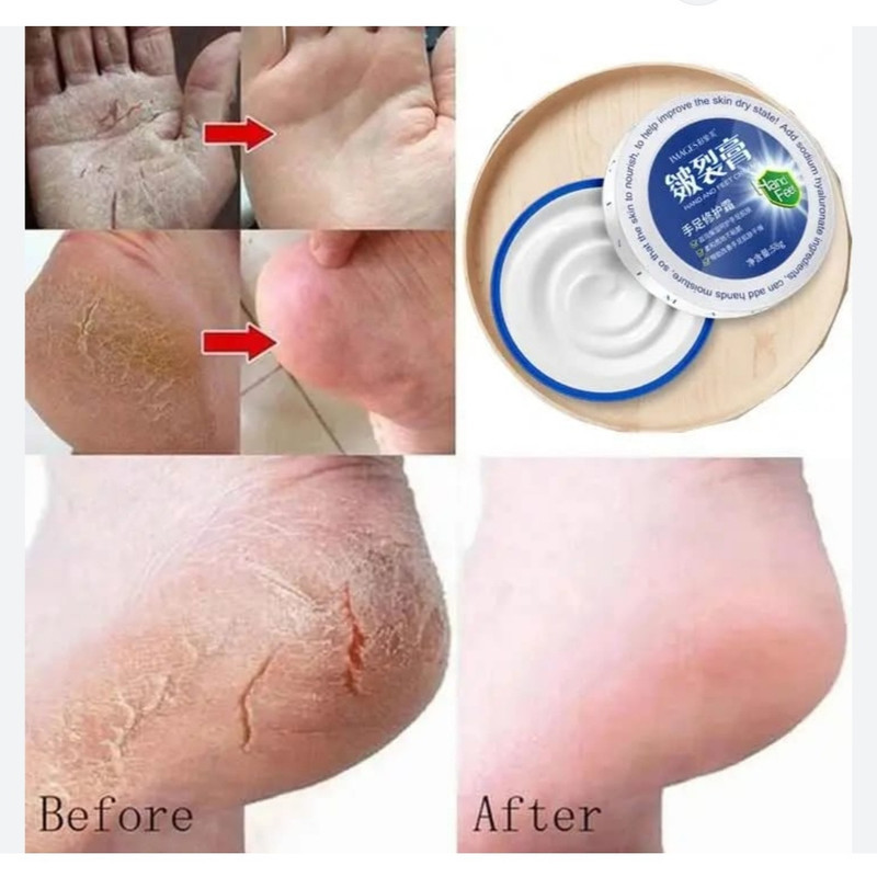 کرم ترک دست و پا ایمجز مدل هیالورونیک اسید وزن ۵۸ گرم