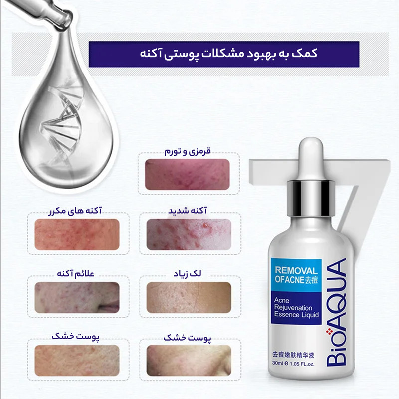 سرم ضدجوش بایو آکوا مدل 001 حجم 30 میلی لیتر