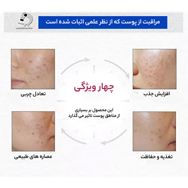 کرم ضد جوش بایو آکوا مدل Go Blain Blain وزن 30 گرم