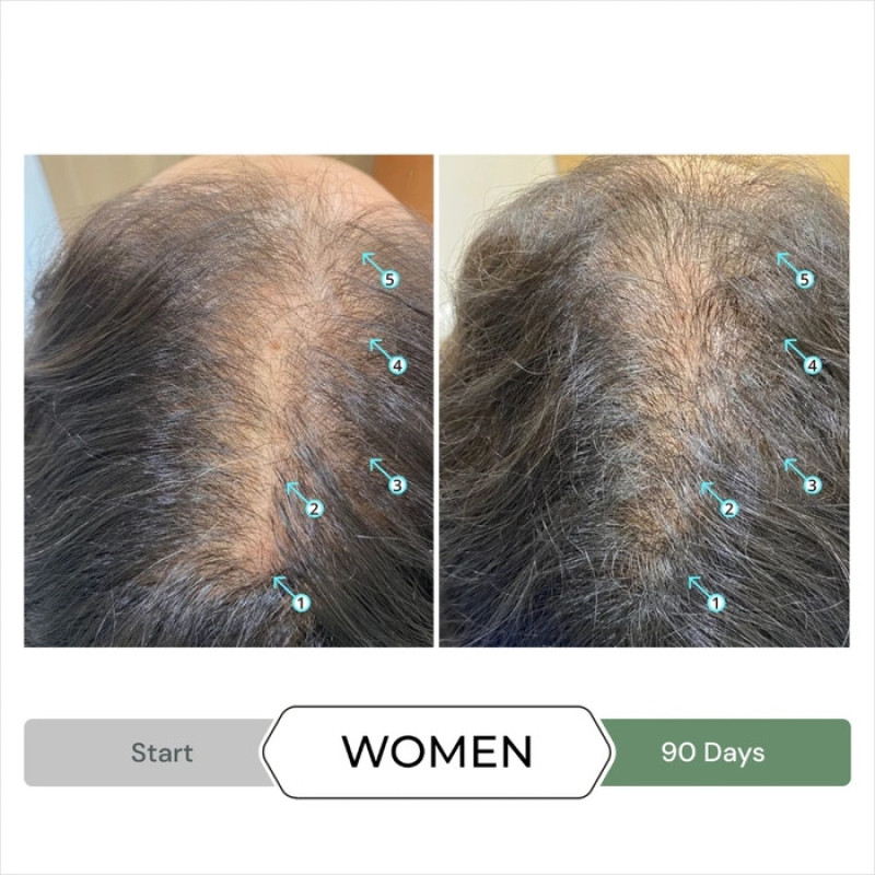 شامپو تقویت کننده و ضد ریزش مو دی اس لابراتوریس مدل Revita.CBD مناسب برای انواع مو حجم ۲۰۵ میلی لیتر