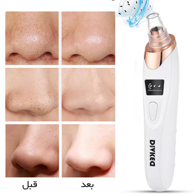 میکرودرم دیوکید مدل DD-1022