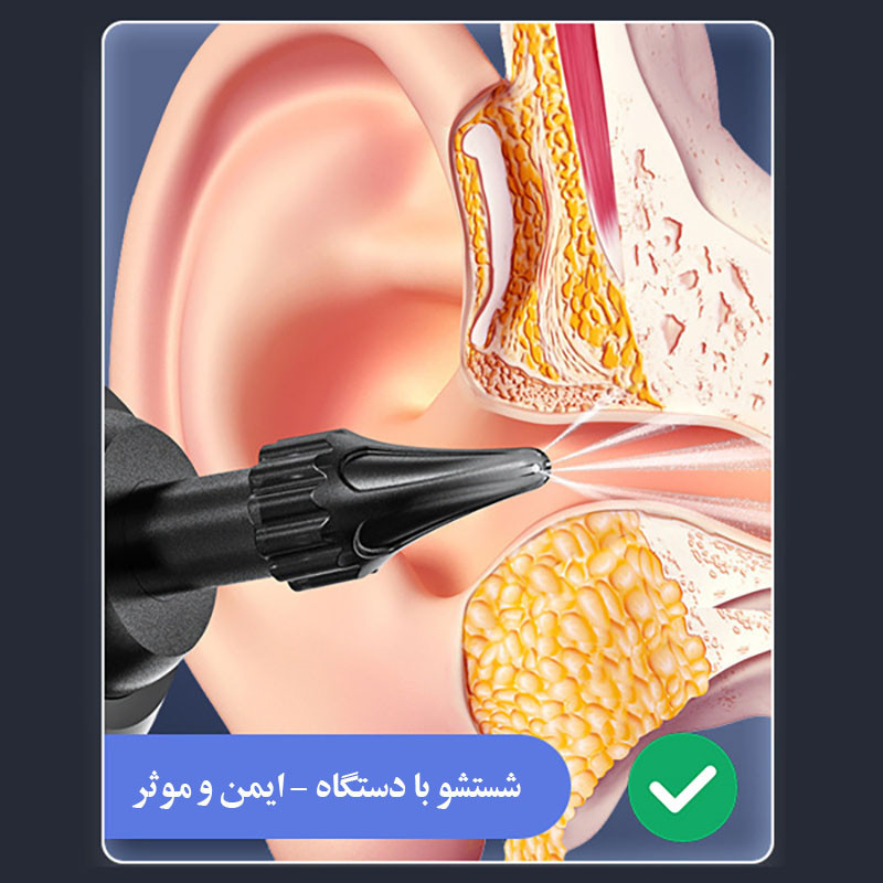 گوش پاک‌کن برقی مدل  Remover