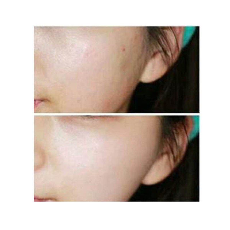 کپسول ضد چروک صورت و دور چشم انیمیت مدل ویتامین E حجم 10 میلی لیتر مجموعه 10 عددی
