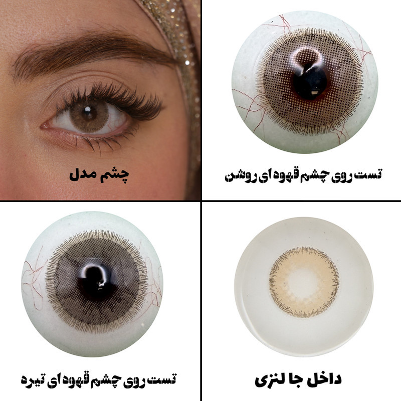 لنز چشم رویال ویژن مدل LUXURY BR کد 36 رنگ قهوه ای طبیعی دوردار
