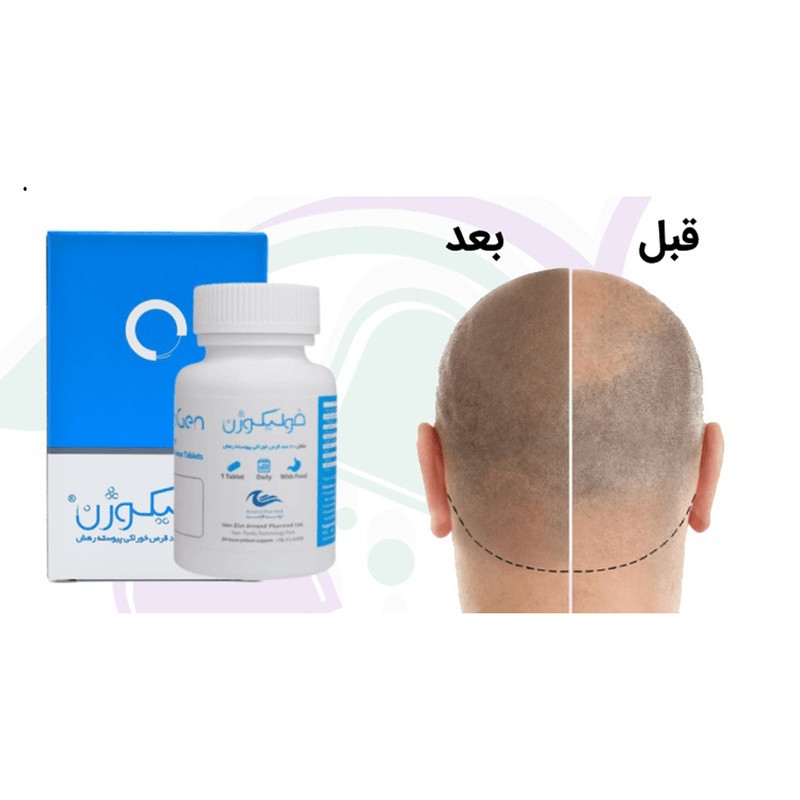مکمل تقویت مو، پوست و ناخن اروند فارمد مدل فولیکوژن حاوی فولیک اسید و ویتامین D3 بسته 60 عددی ضد ریزش مو و حفظ استحکام پوست