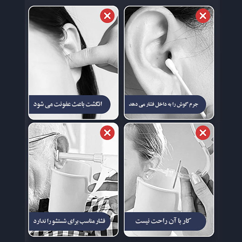 گوش پاک‌کن برقی مدل  Remover