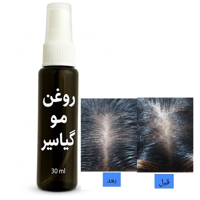 روغن موی سیر سیاه سینا مدل گیاسیر حجم ۳۰ میلی‌لیتر