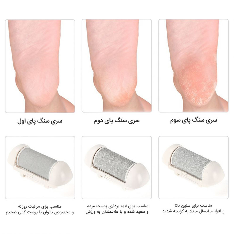 سنگ پا برقی مدل CA001 به همراه سری یدک بسته 2 عددی