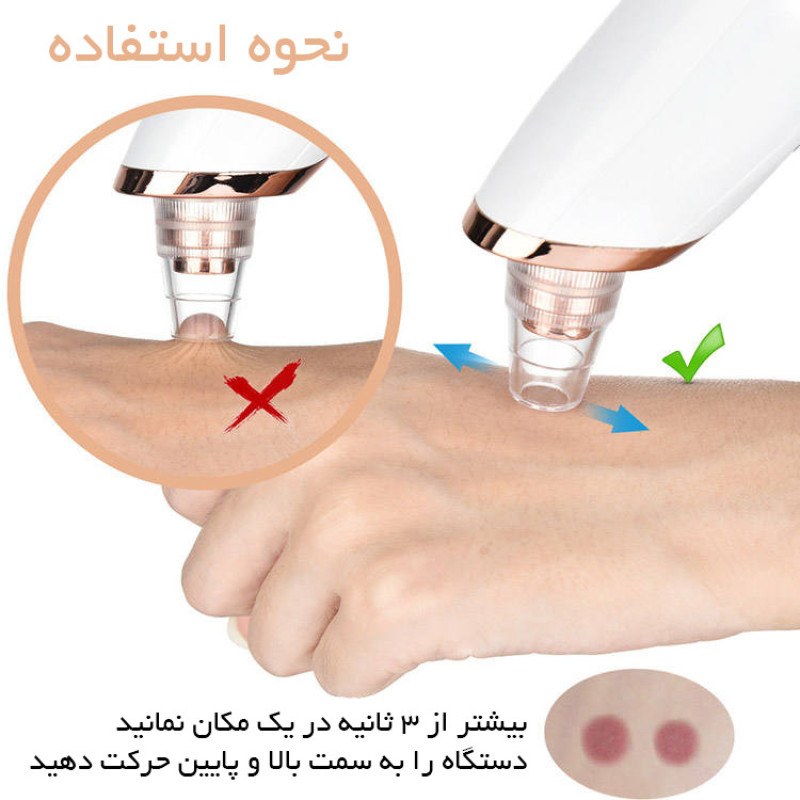 میکرودرم دیوکید مدل DD-1022