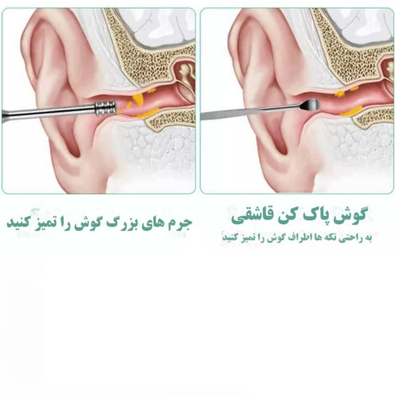مجموعه نظافت گوش مدل Ear-MK بسته 6 عددی
