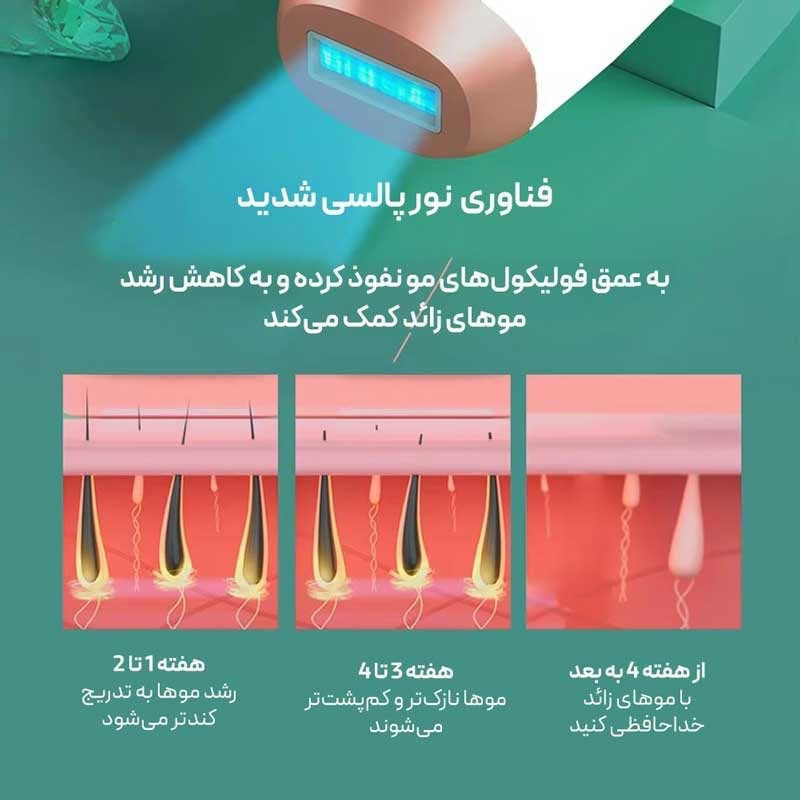 لیزر موهای زائد ورا مدل TMY02