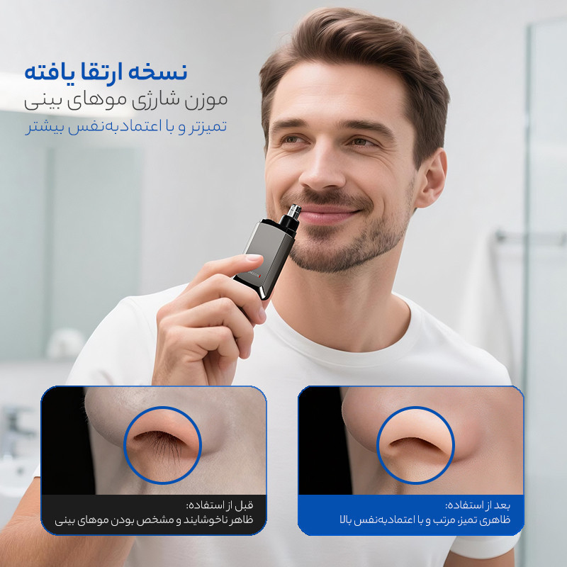 مو زن گوش و بینی کمنگدن مدل 0.0.7