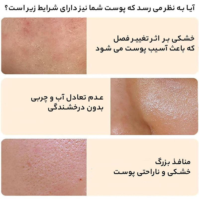 اسکراب لایه بردار پوست بایواکوا مدل  Brightening Exfoliating Rice Gel حجم 140 میلی لیتر