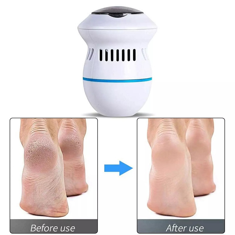 سنگ پا برقی مدل Motorized