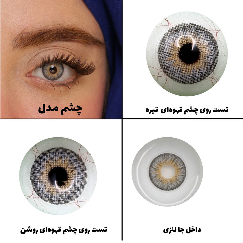لنز چشم رویال ویژن مدل PLATINIUM کد 33 رنگ طوسی