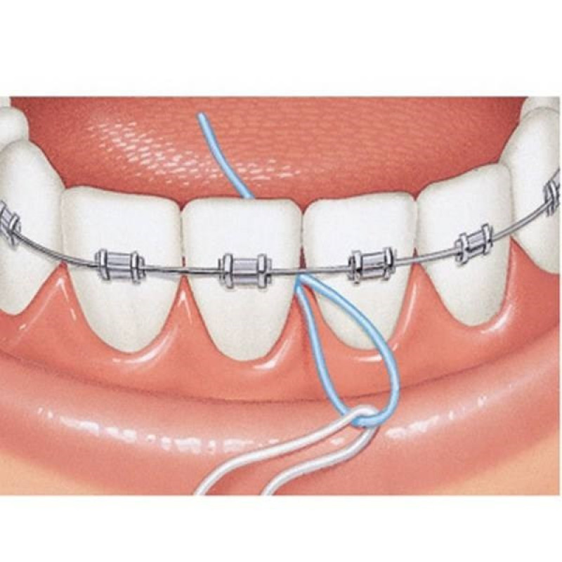 نخ دندان کانفیدنت مدل Floss Threaders