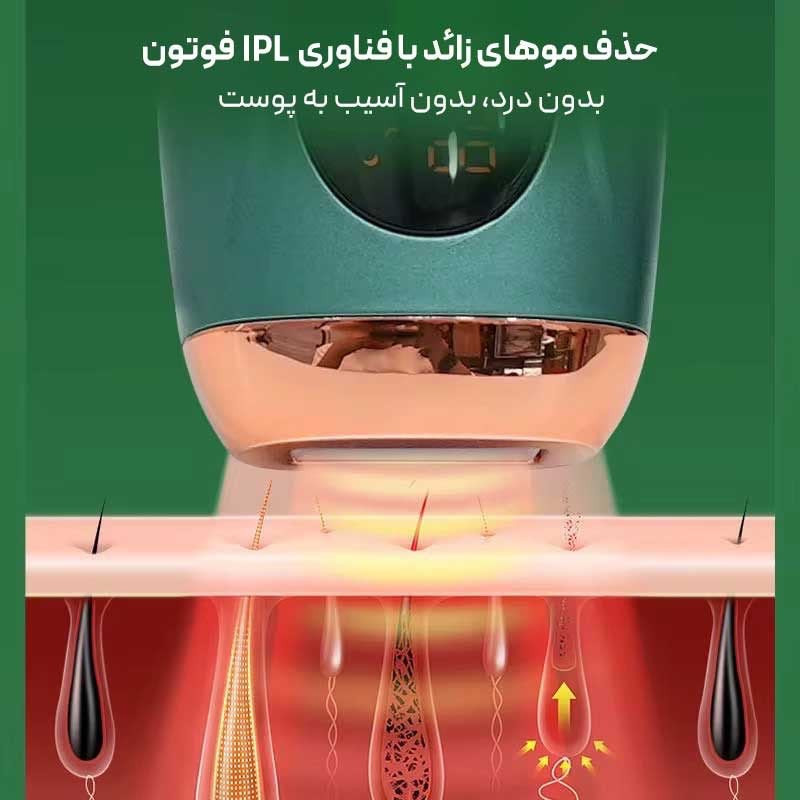 لیزر موهای زائد ورا مدل TMY02