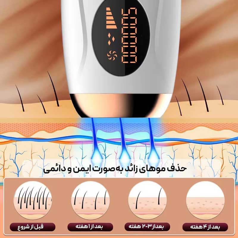 لیزر موهای زائد ورا مدل TMY02