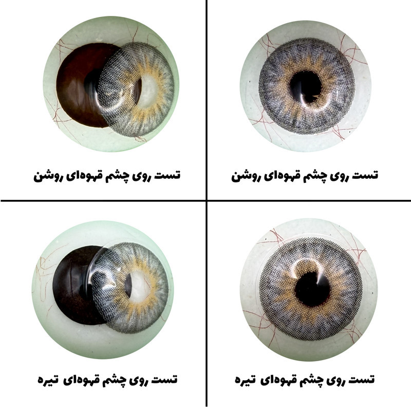 لنز چشم رویال ویژن مدل PLATINIUM کد 33 رنگ طوسی