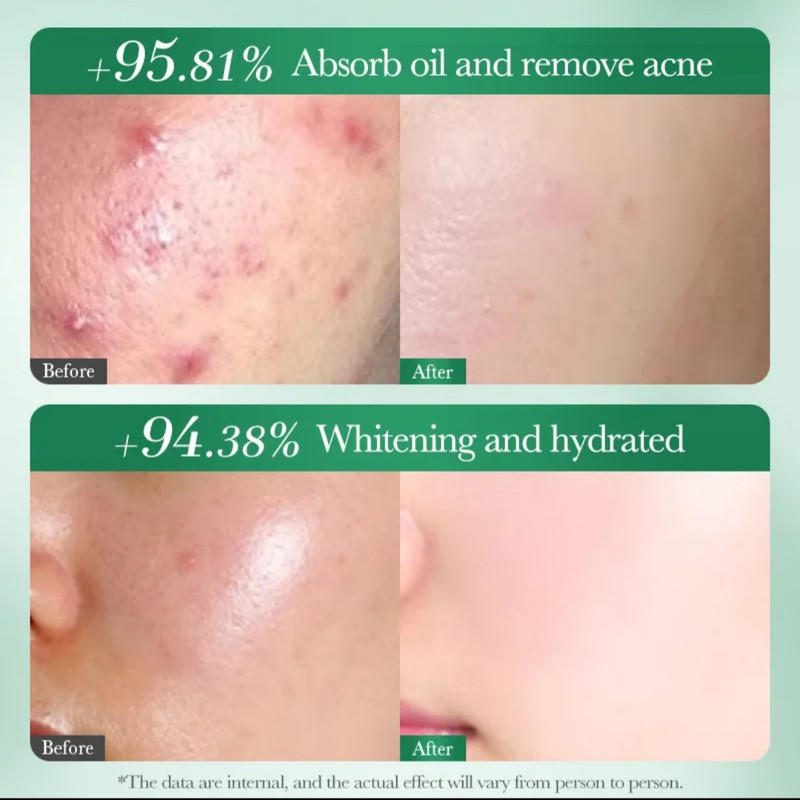 فوم ضد جوش صورت سادور مدل ANTI-ACNE مناسب برای پوست آکنه‌ای وزن 100 گرم
